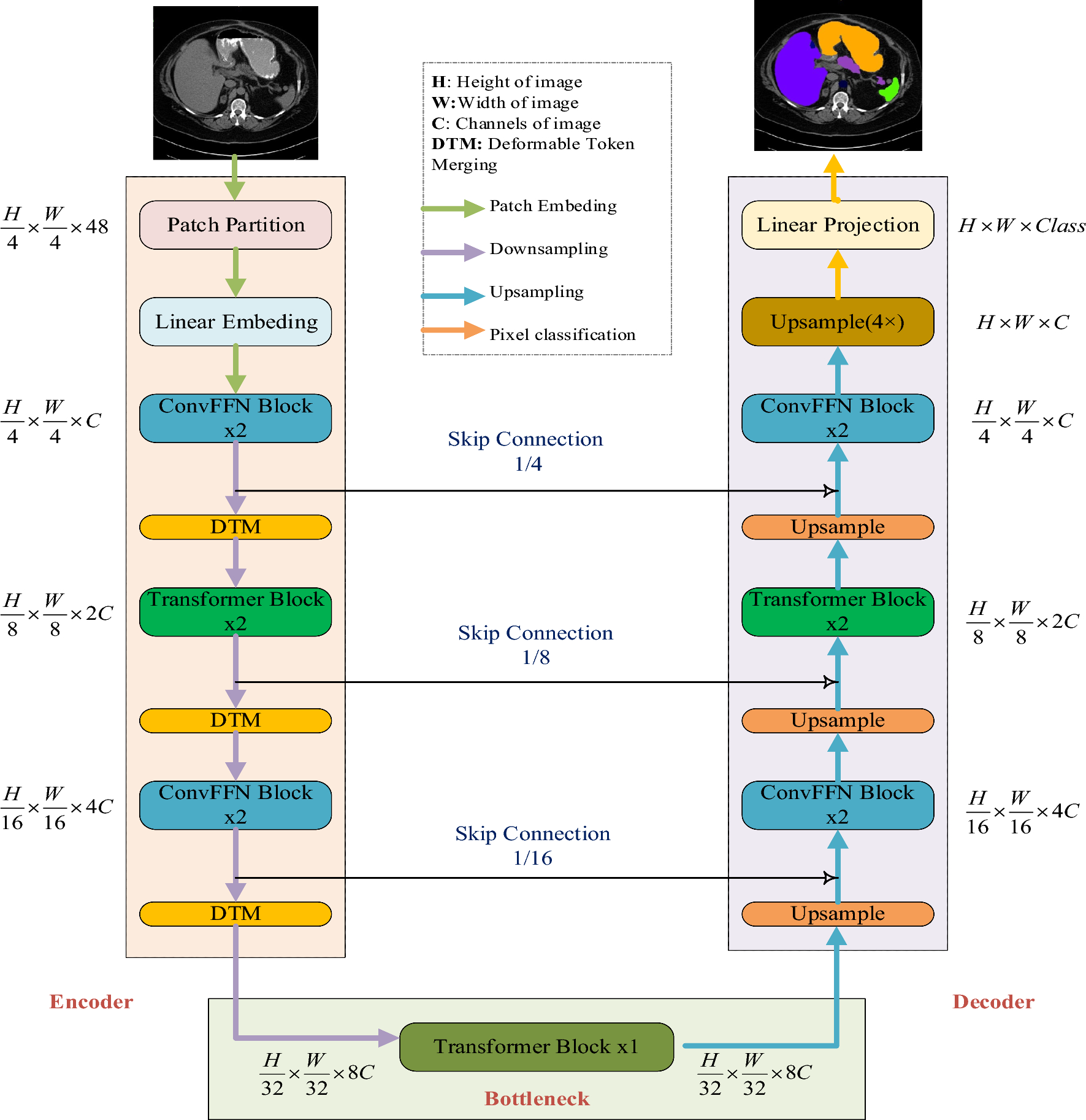 LIT-Unet: a lightweight and effective model for medical image segmentation