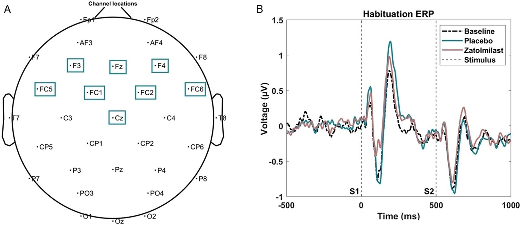 Auditory N1 event-related potential amplitude is predictive of serum concentration of BPN14770 in fragile X syndrome