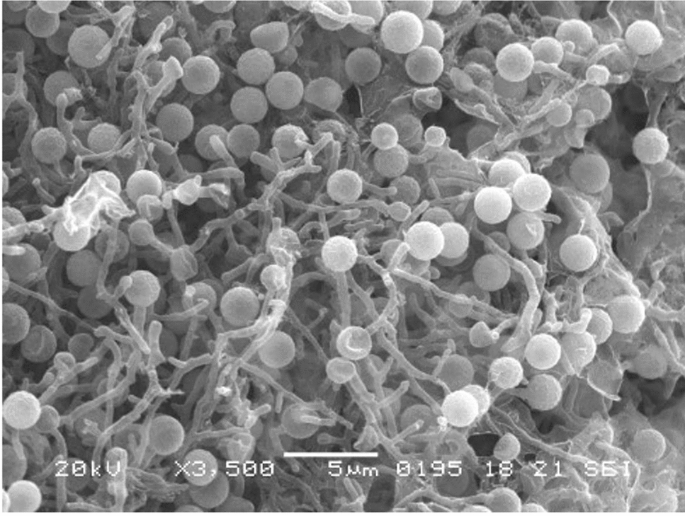 Polyphasic Identification of Rhizomonospora bruguierae gen. nov., sp. nov., Isolated from Mangrove Rhizosphere Soil