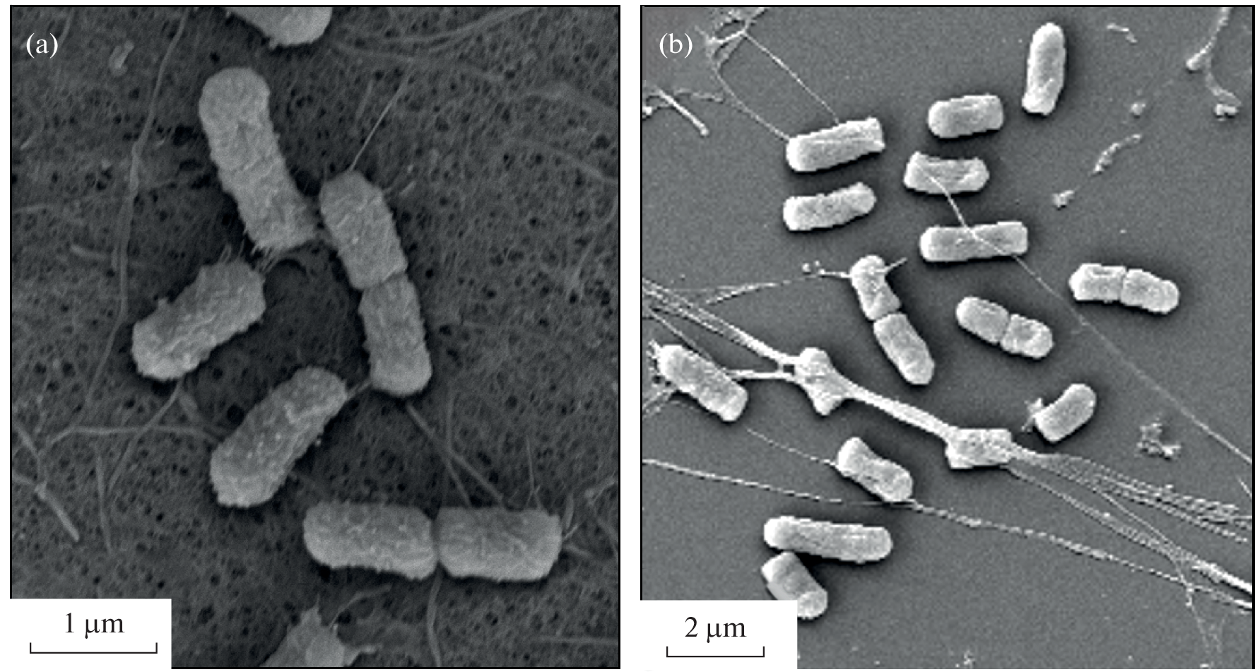 Inactivation of Type 3 Fimbriae Increases Adhesion of Klebsiella oxytoca to Lung Epithelial Cells