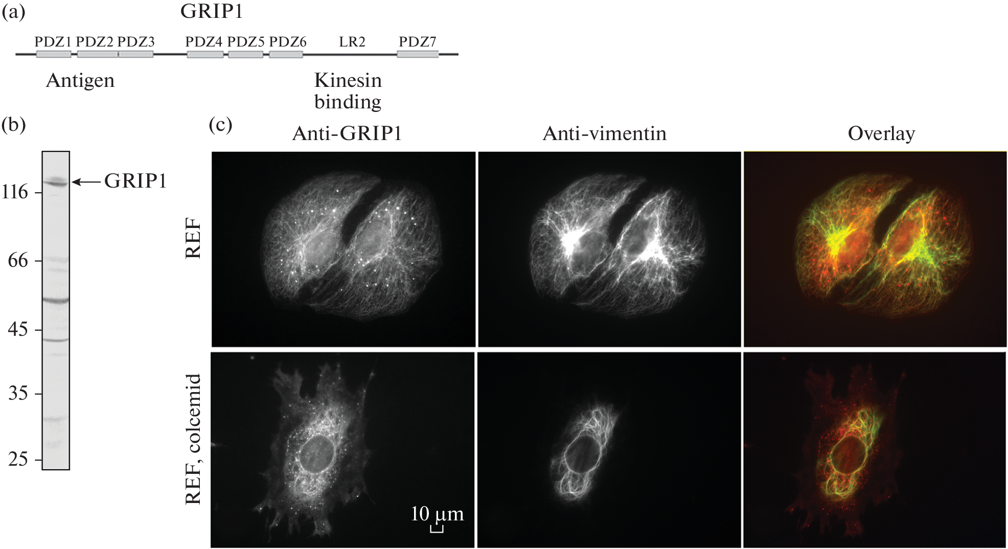 GRIP1 is Involved in the Interaction of Vimentin Filaments with Focal Adhesions in Endothelial Cells