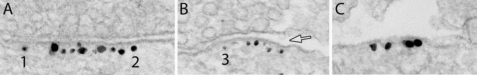 Ultrastructural characterization of hippocampal inhibitory synapses under resting and stimulated conditions