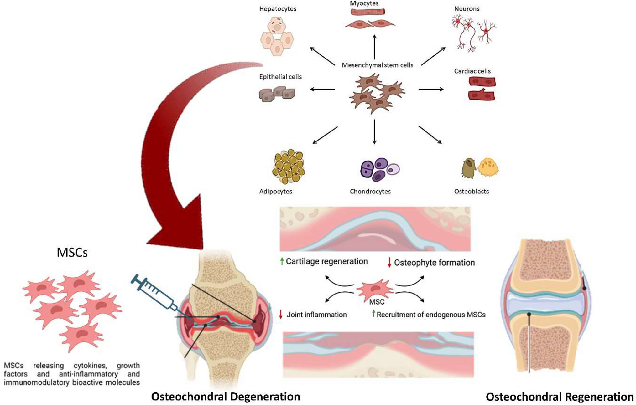 Unleashing the Healing Power of Mesenchymal Stem Cells for Osteochondral Abnormalities