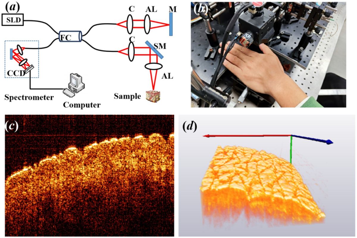 Estimation of skin surface roughness in vivo based on optical coherence tomography combined with convolutional neural network