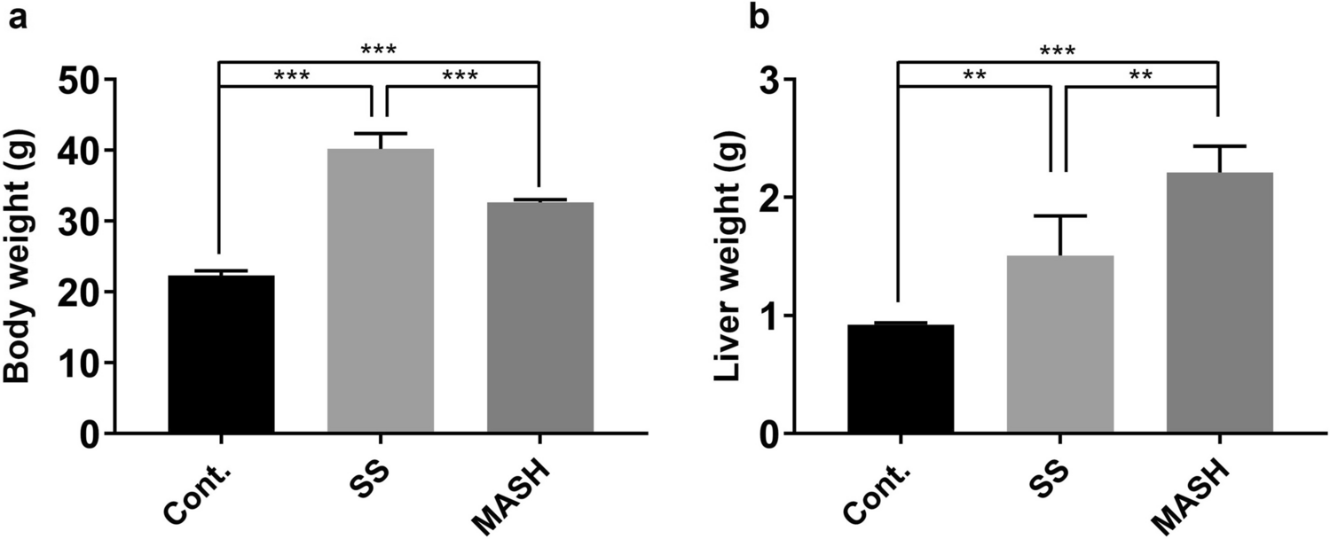 Thymidine Phosphorylase Imaging Probe for Differential Diagnosis of Metabolic dysfunction-associated Steatohepatitis