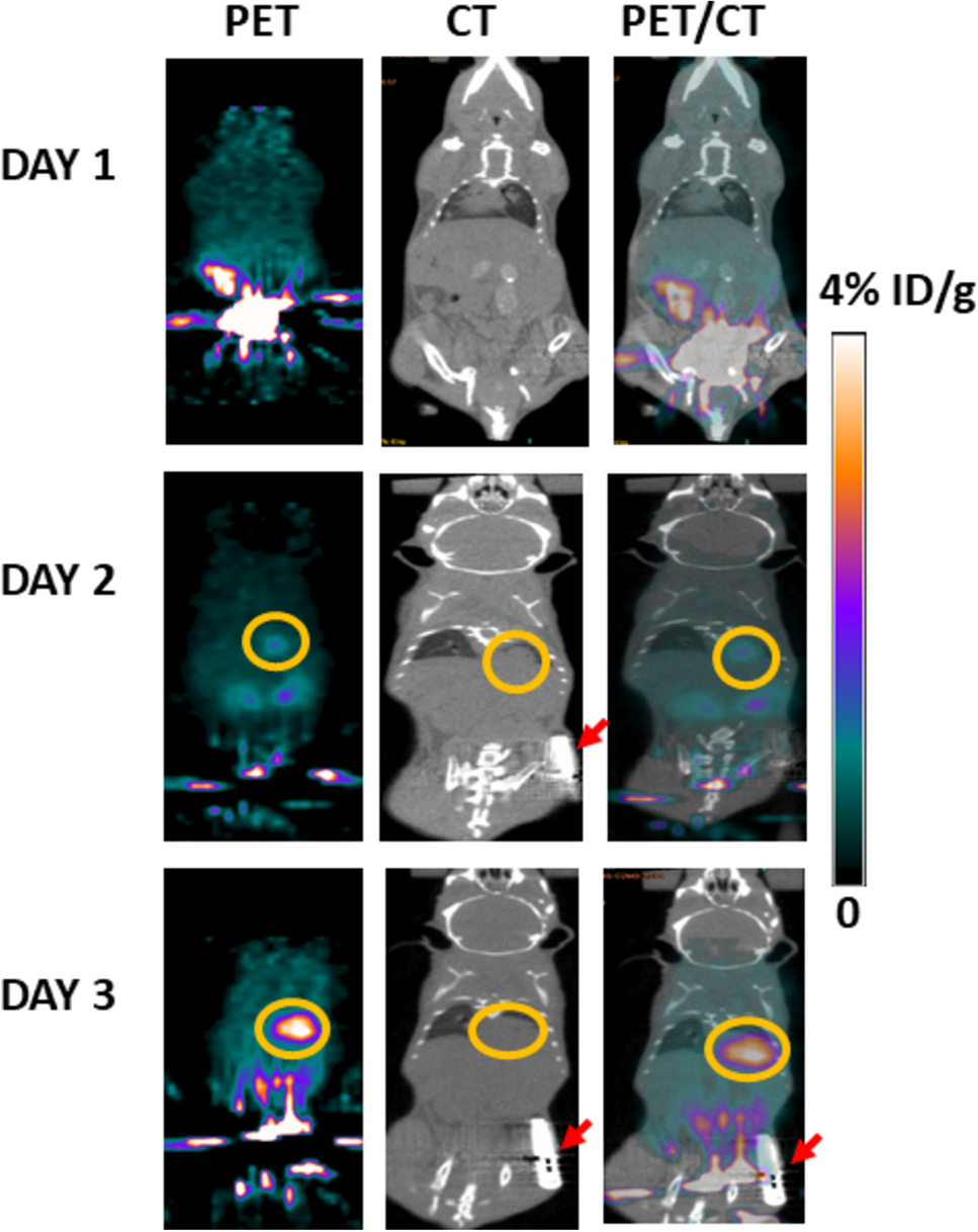 Differentiation Between Responders and Non-Responders to Antibiotic Treatment in Mice Using 18F-Fluorodeoxysorbitol/PET