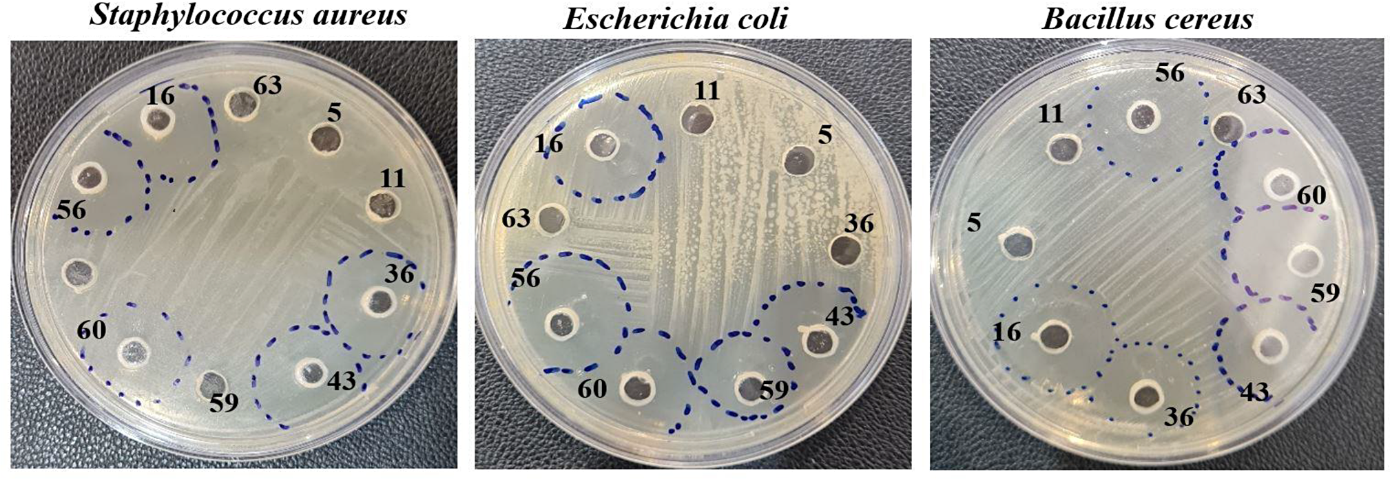 Evaluation of antibacterial and anticancer properties of secondary metabolites isolated from soil Bacillus spp focusing on two strains of Bacillus licheniformis and Bacillus siamensis