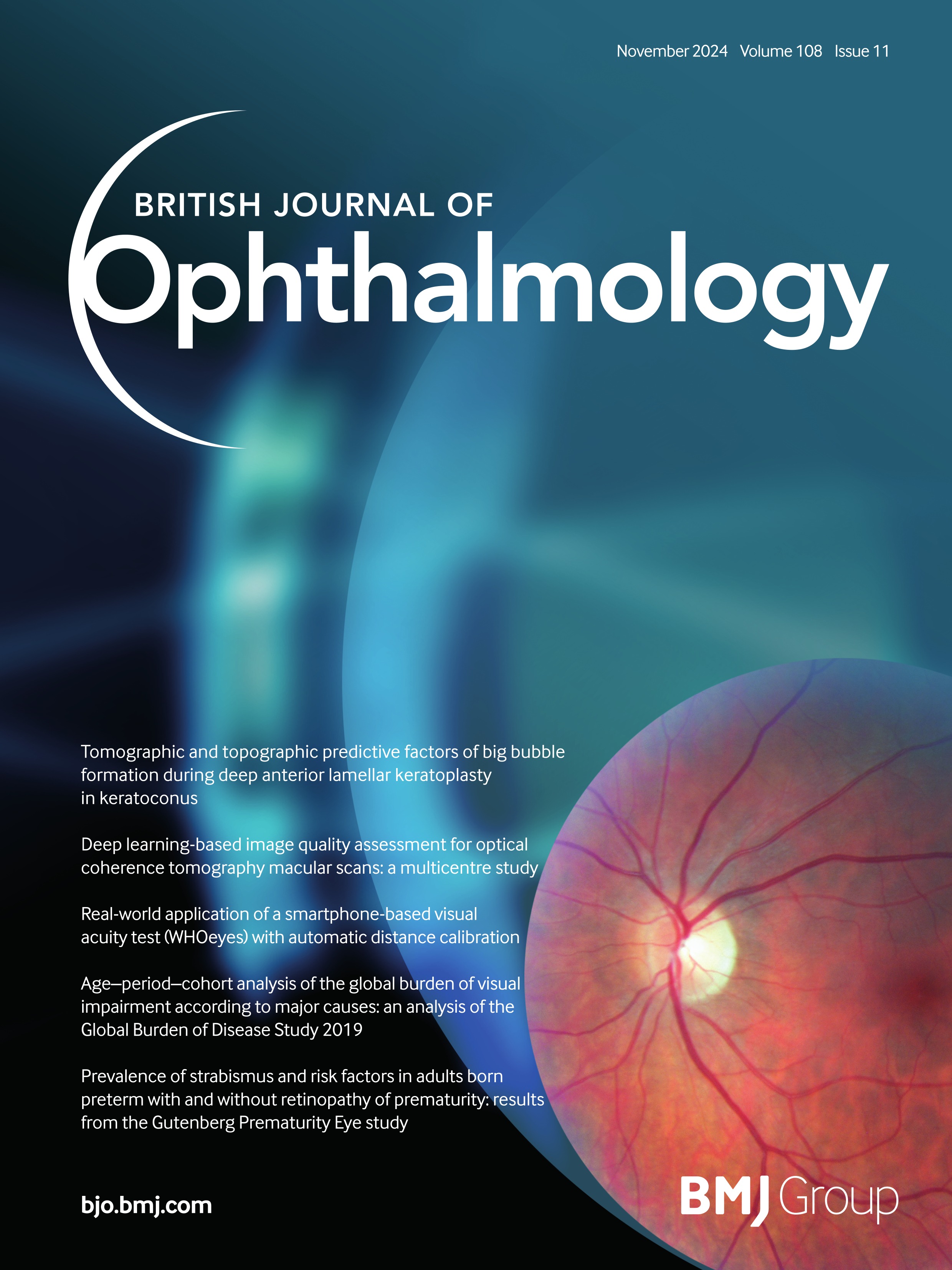 Predictive model for iris melanoma