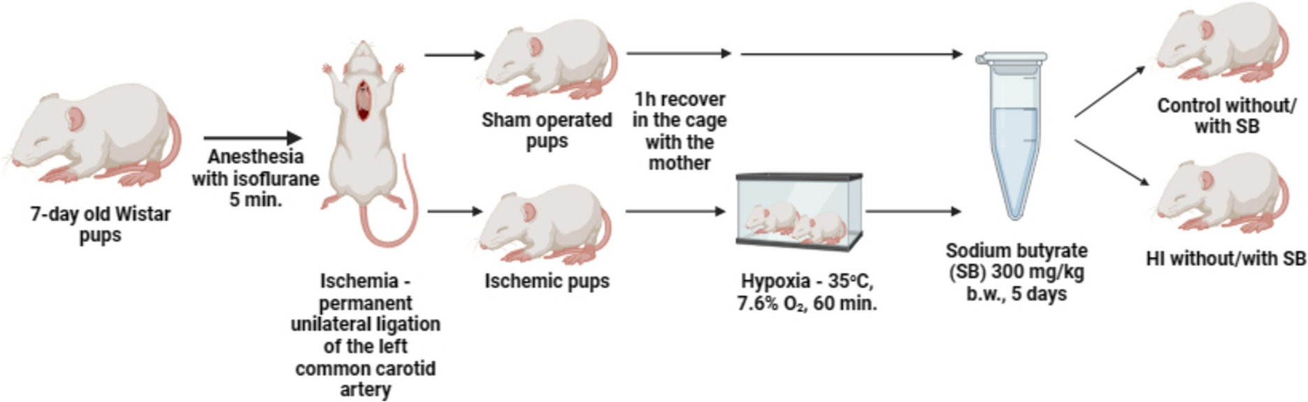 The Impact of the Histone Deacetylase Inhibitor—Sodium Butyrate on Complement-Mediated Synapse Loss in a Rat Model of Neonatal Hypoxia–Ischemia