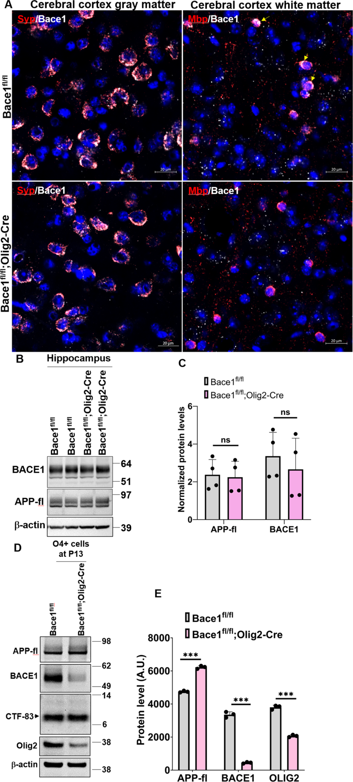 Contribution of amyloid deposition from oligodendrocytes in a mouse model of Alzheimer’s disease