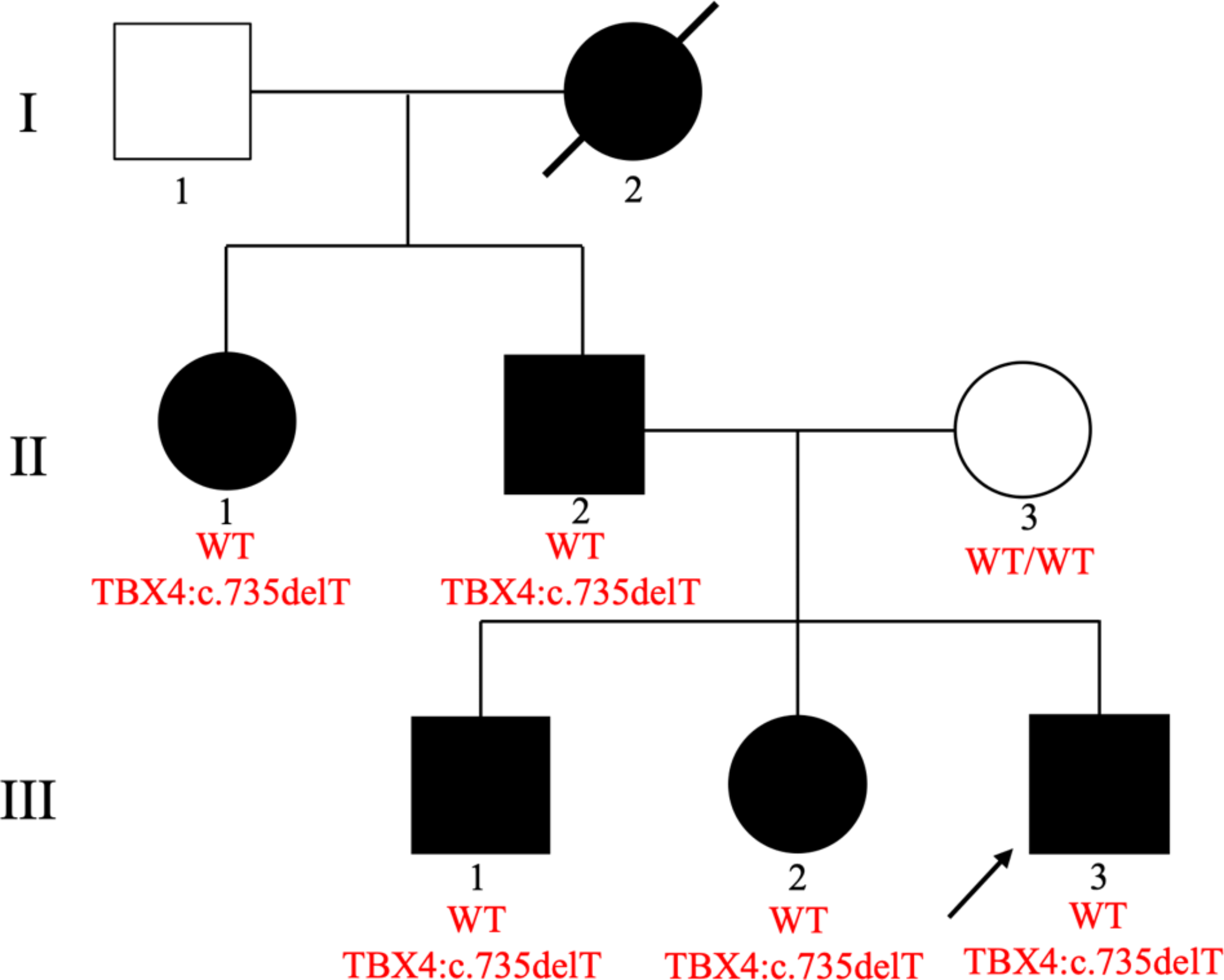 A novel frameshift TBX4 variant in a family with ischio-coxo-podo-patellar syndrome and variable severity