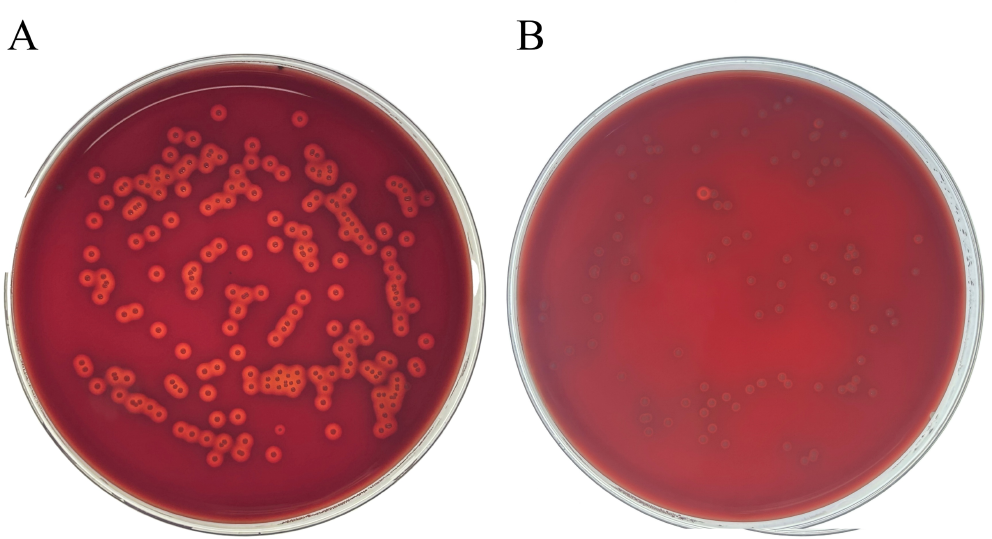 Transcriptome analysis of tilapia streptococcus agalactiae in response to baicalin