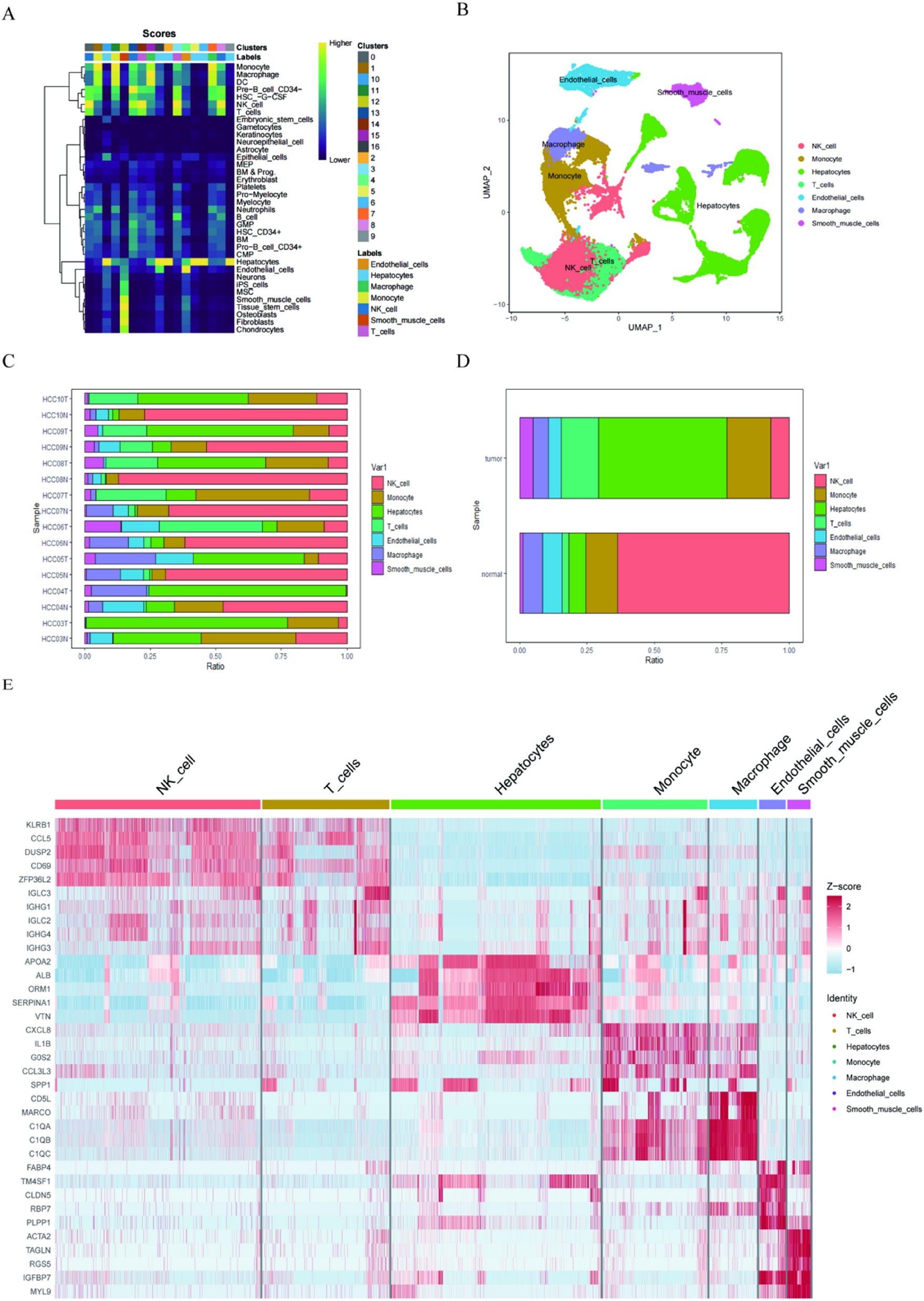 Machine learning identification of NK cell immune characteristics in hepatocellular carcinoma based on single-cell sequencing and bulk RNA sequencing