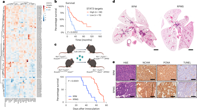 A STAT3–STING–IFN axis controls the metastatic spread of small cell lung cancer