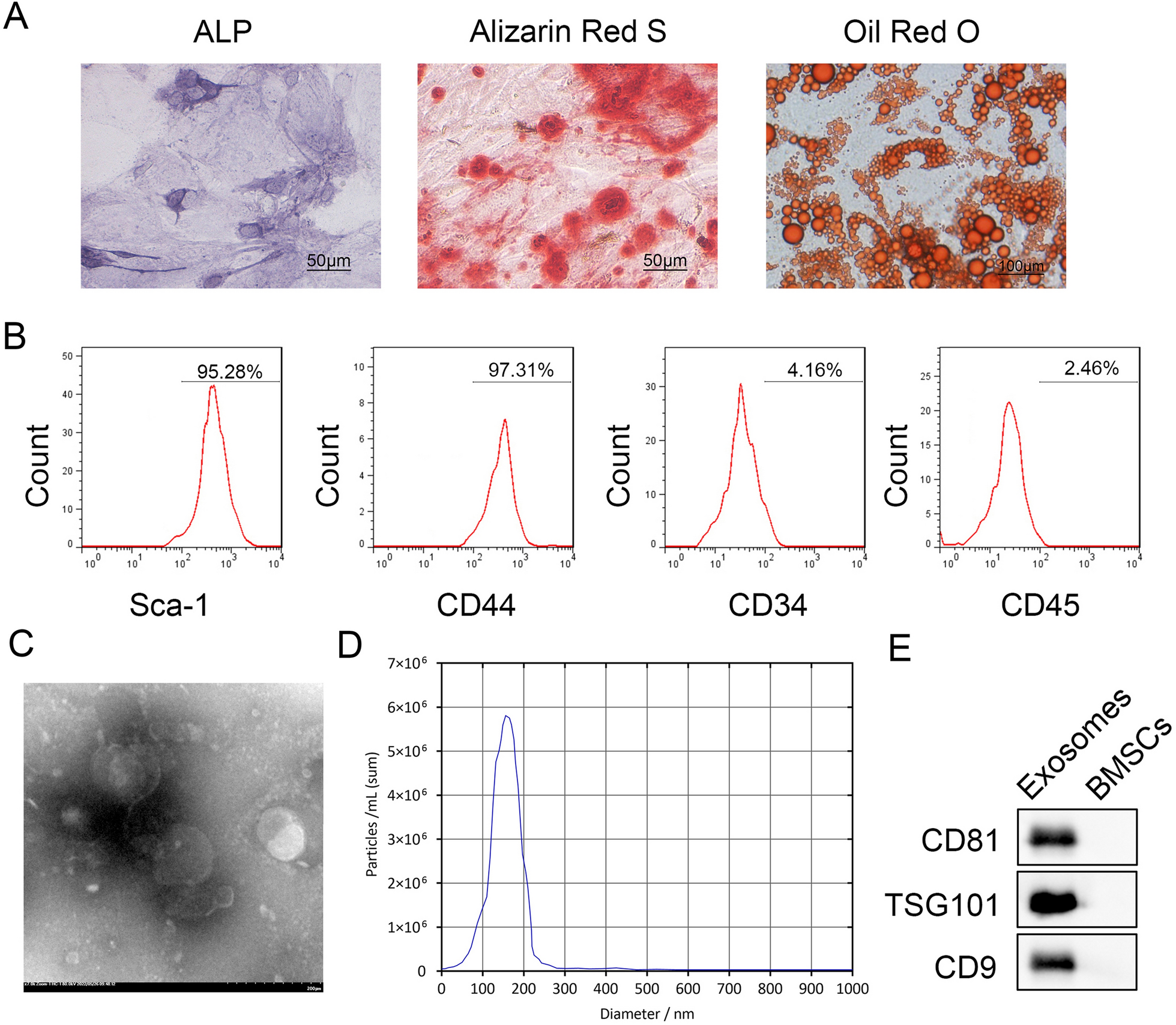 BMSC-derived exosomes promote osteoporosis alleviation via M2 macrophage polarization