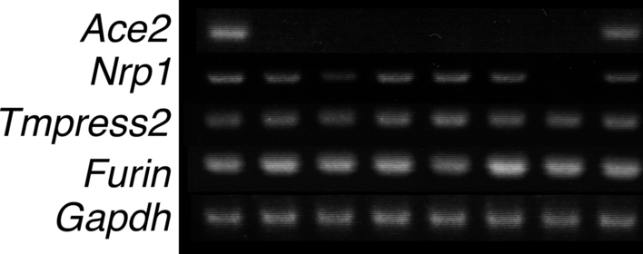 Expression of SARS-CoV-2 entry molecules ACE2, NRP1, TMPRSS2, and FURIN in the reproductive tissues of male macaques