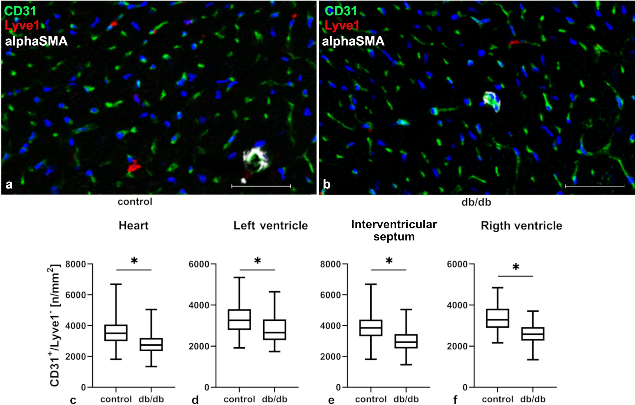 Expression of mRNA for molecules that regulate angiogenesis, endothelial cell survival, and vascular permeability is altered in endothelial cells isolated from db/db mouse hearts