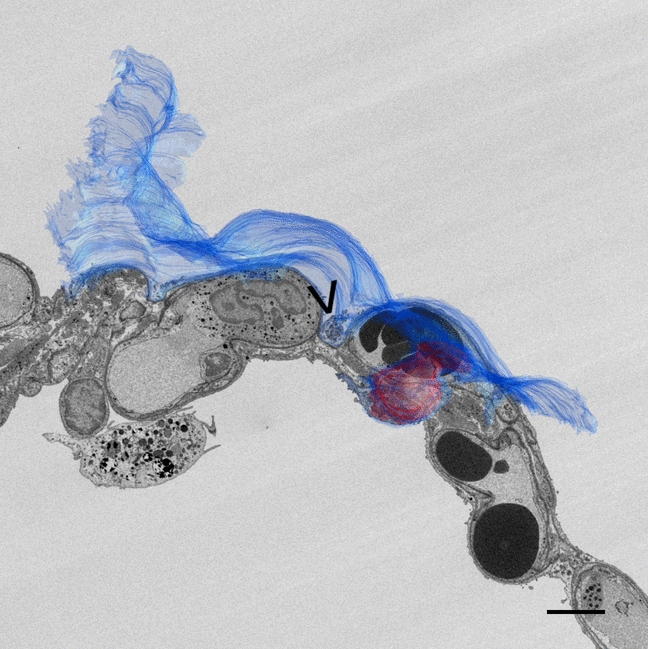 Distribution and volume of mitochondria in alveolar epithelial type 1 cells in infant and adult human lungs