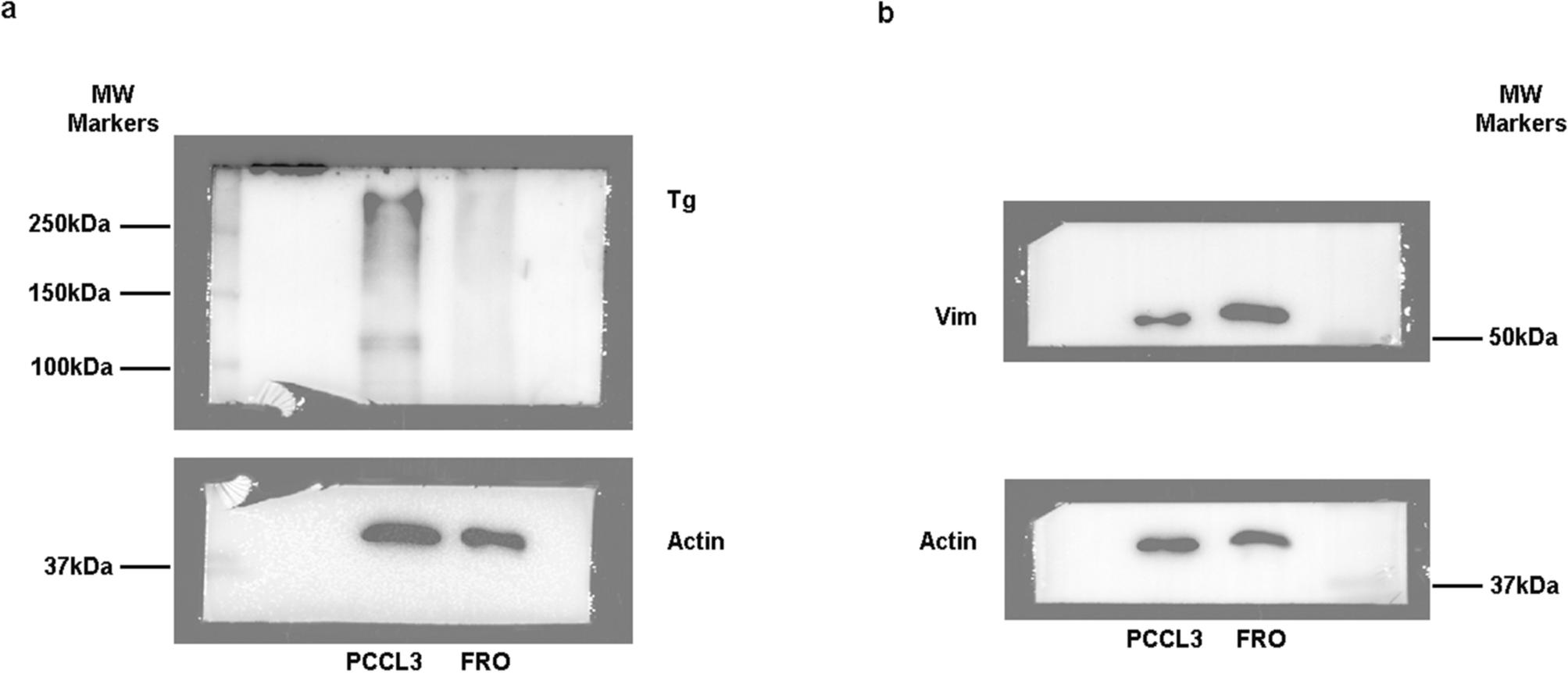 Anaplastic thyroid carcinoma: vimentin segregates at the invasive front of tumors in a murine xenograft model