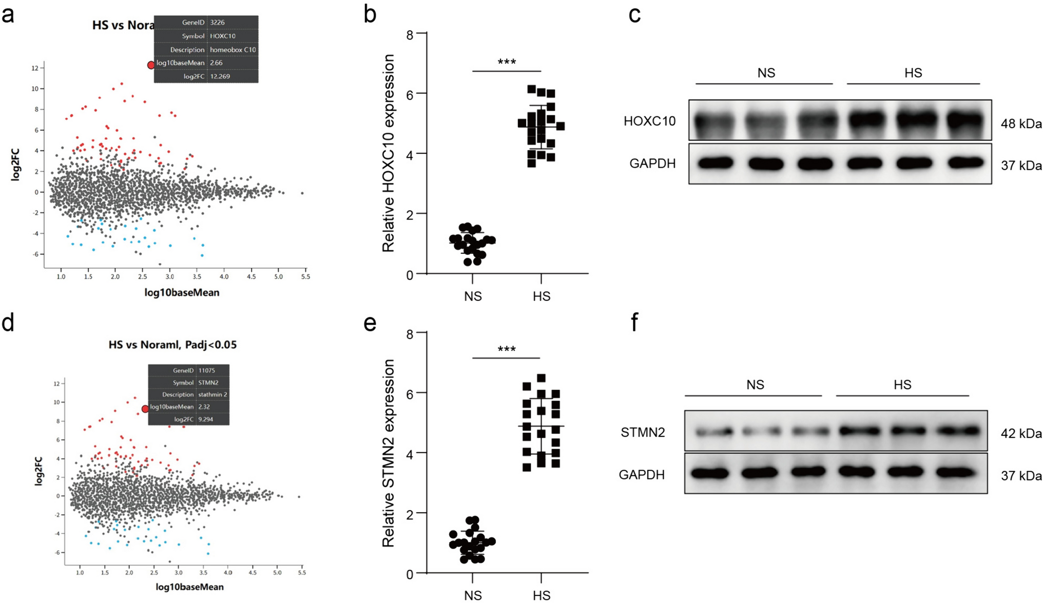 HOXC10 promotes hypertrophic scar fibroblast fibrosis through the regulation of STMN2 and the TGF-β/Smad signaling pathway