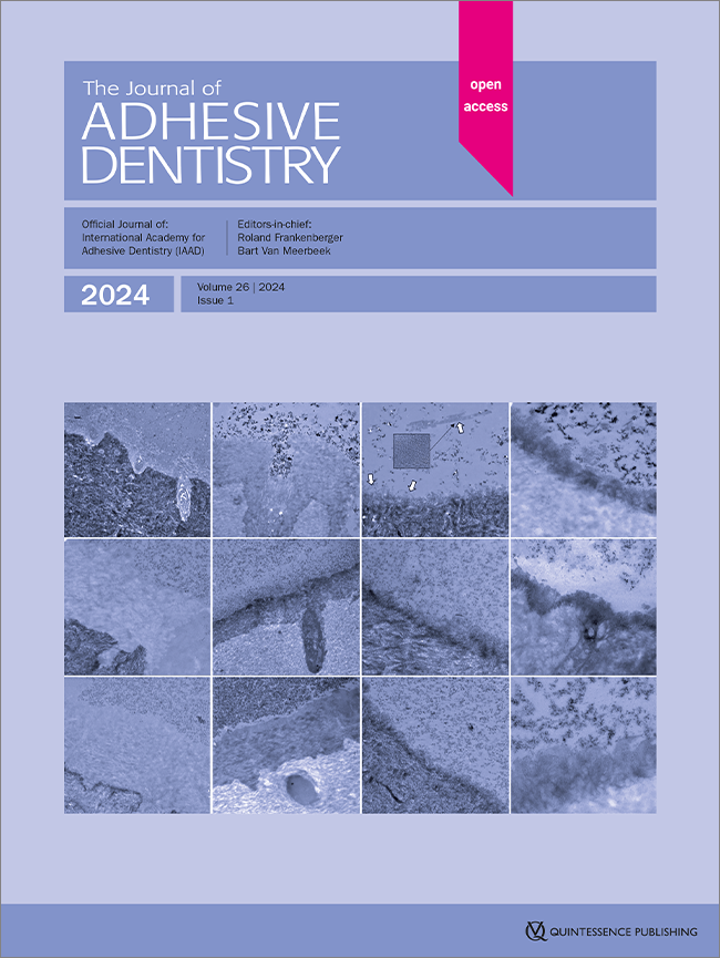 Four-year Outcomes of Class III and IV Anterior Restorations Based on a Subset of German Health Insurance Data