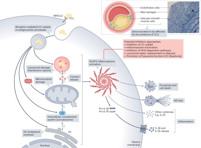 Cholesterol crystals in the pathogenesis of atherosclerosis