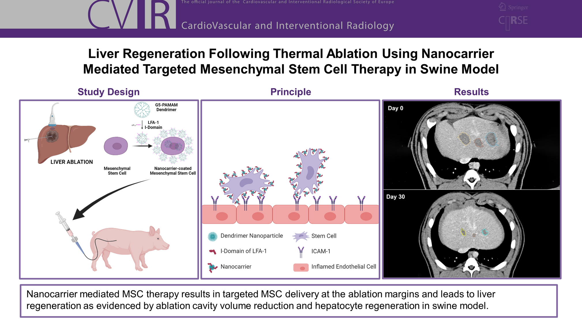 Liver Regeneration Following Thermal Ablation Using Nanocarrier Mediated Targeted Mesenchymal Stem Cell Therapy