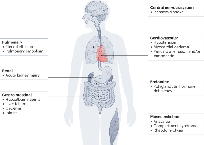 Systemic capillary leak syndrome