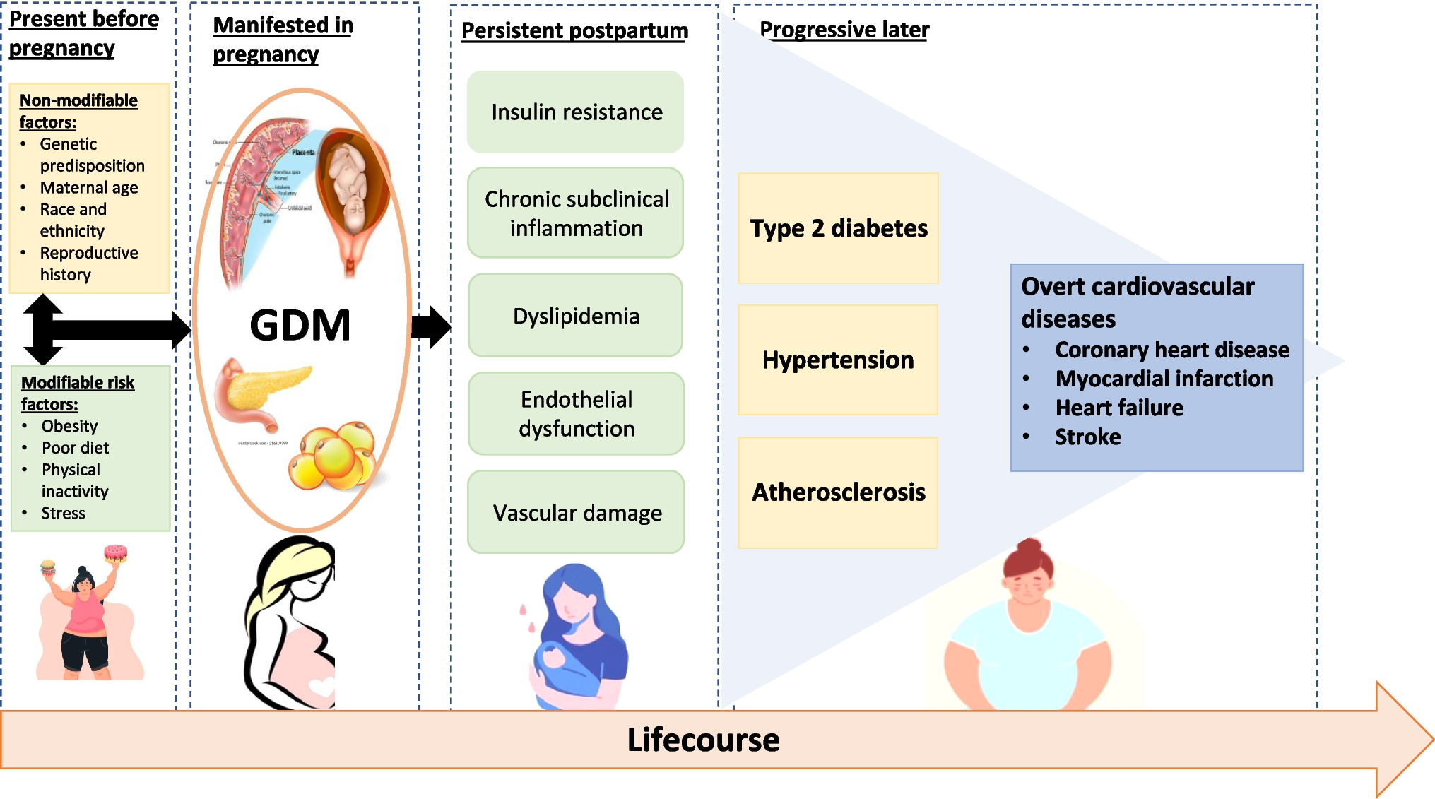 Gestational Diabetes Mellitus and Subsequent Risks of Diabetes and Cardiovascular Diseases: the Life Course Perspective and Implications of Racial Disparities