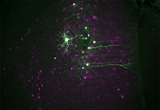 Anti-anxiety and hallucination-like effects of psychedelics mediated by distinct neural circuits