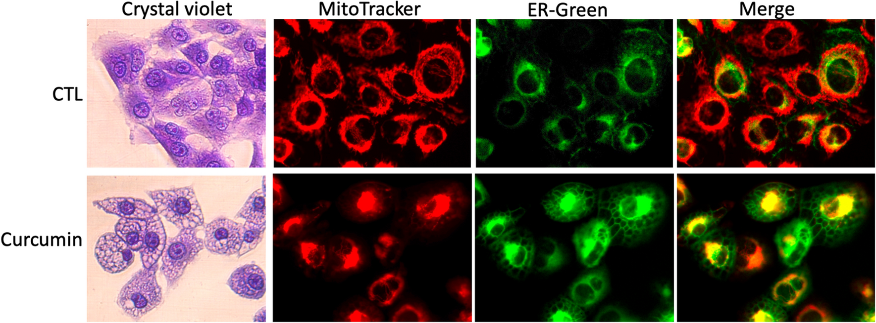 Exploring paraptosis as a therapeutic approach in cancer treatment