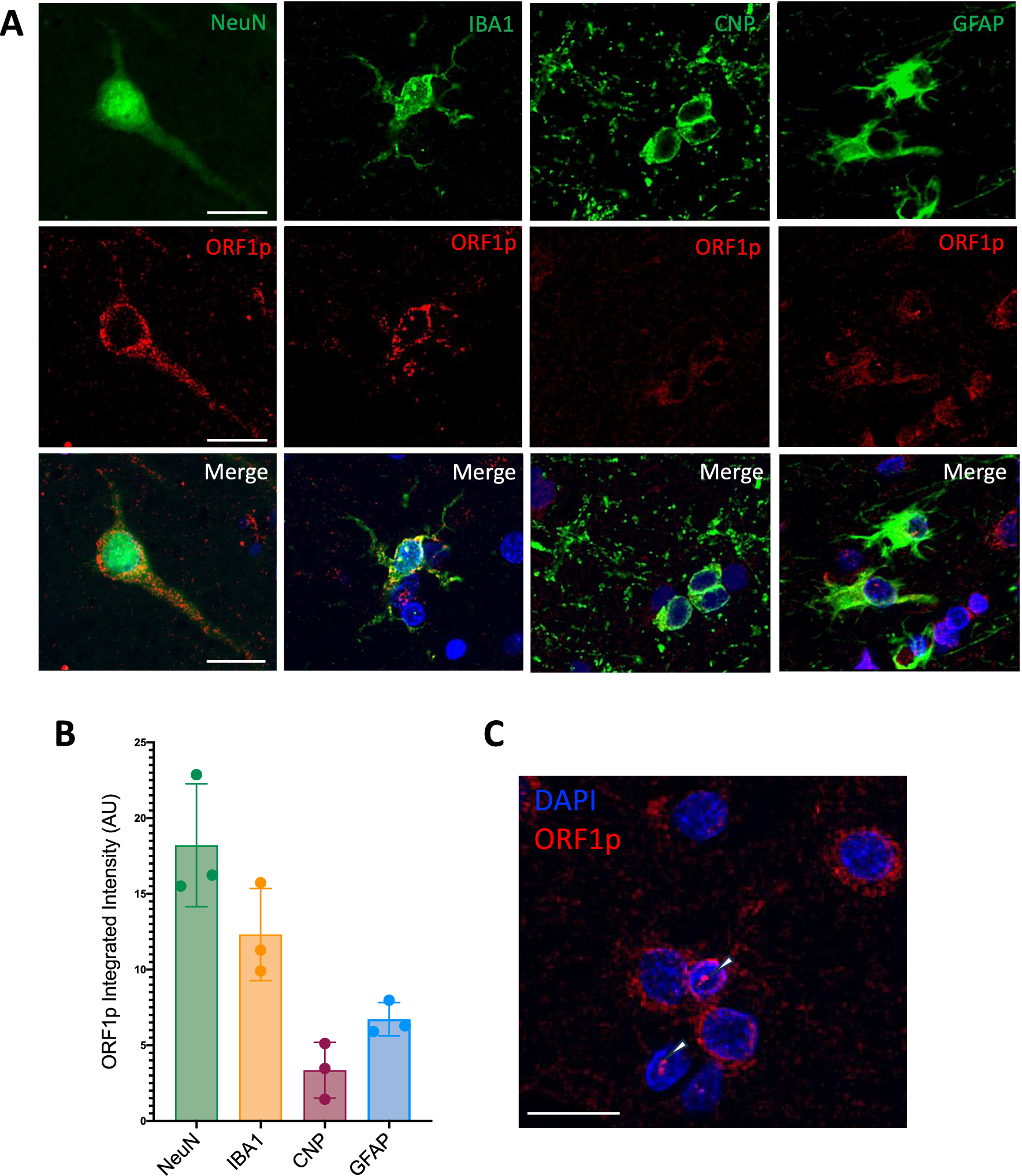 Elevated expression of the retrotransposon LINE-1 drives Alzheimer’s disease-associated microglial dysfunction