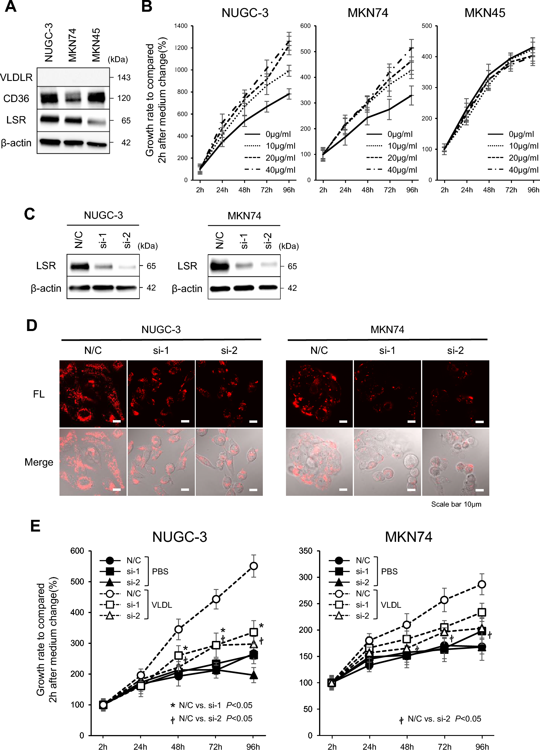 Lipolysis-stimulated lipoprotein receptor promote lipid uptake and fatty acid oxidation in gastric cancer