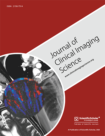 Magnetic resonance imaging spectrum of intracranial meningiomas: An institutional review of common and uncommon imaging appearances