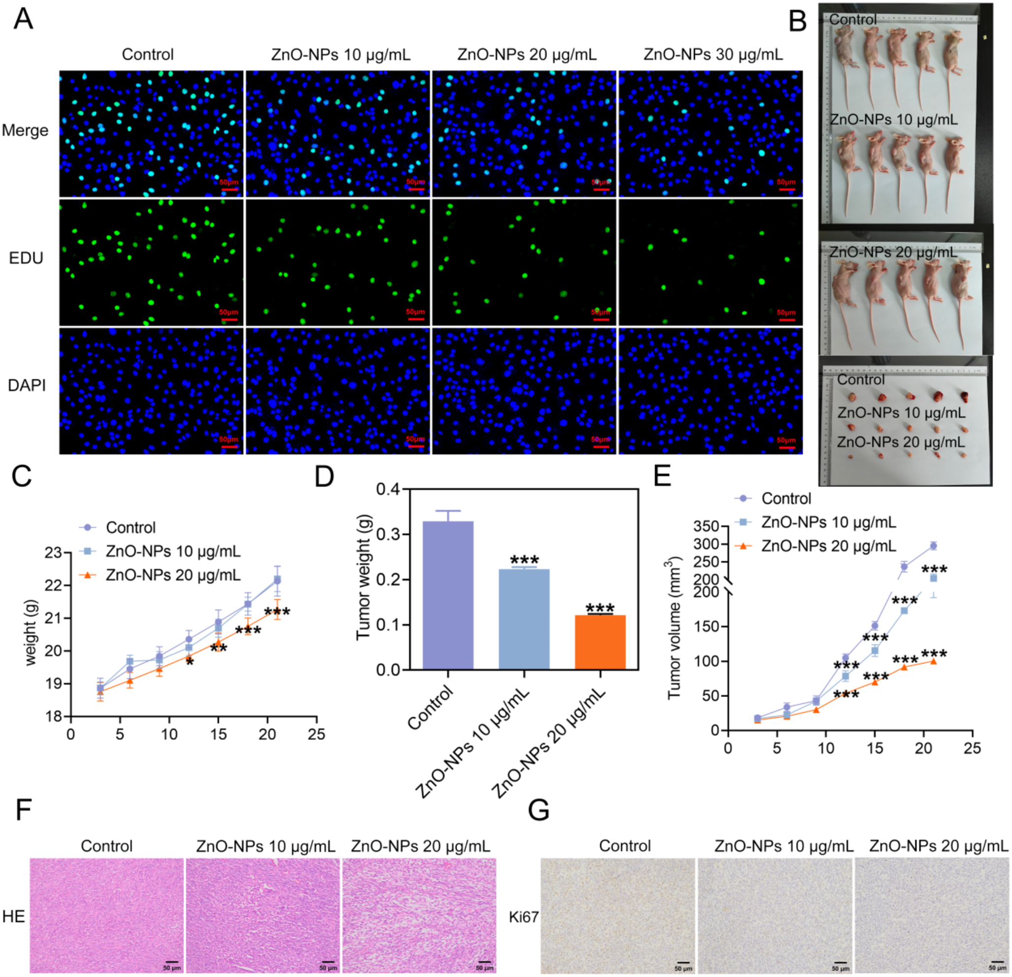 Zinc oxide nanoparticles mitigate the malignant progression of ovarian cancer by mediating autophagy-dependent ferroptosis