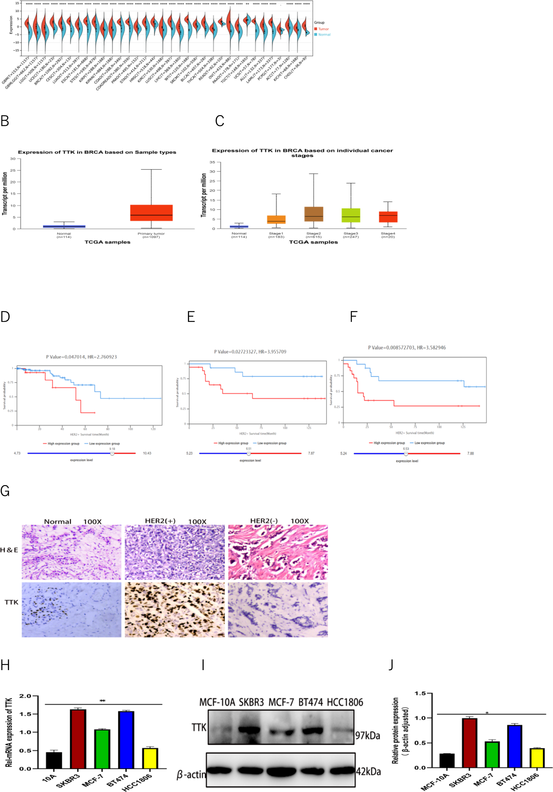 TTK promotes HER2 + breast cancer cell migration, apoptosis, and resistance to targeted therapy by modulating the Akt/mTOR axis