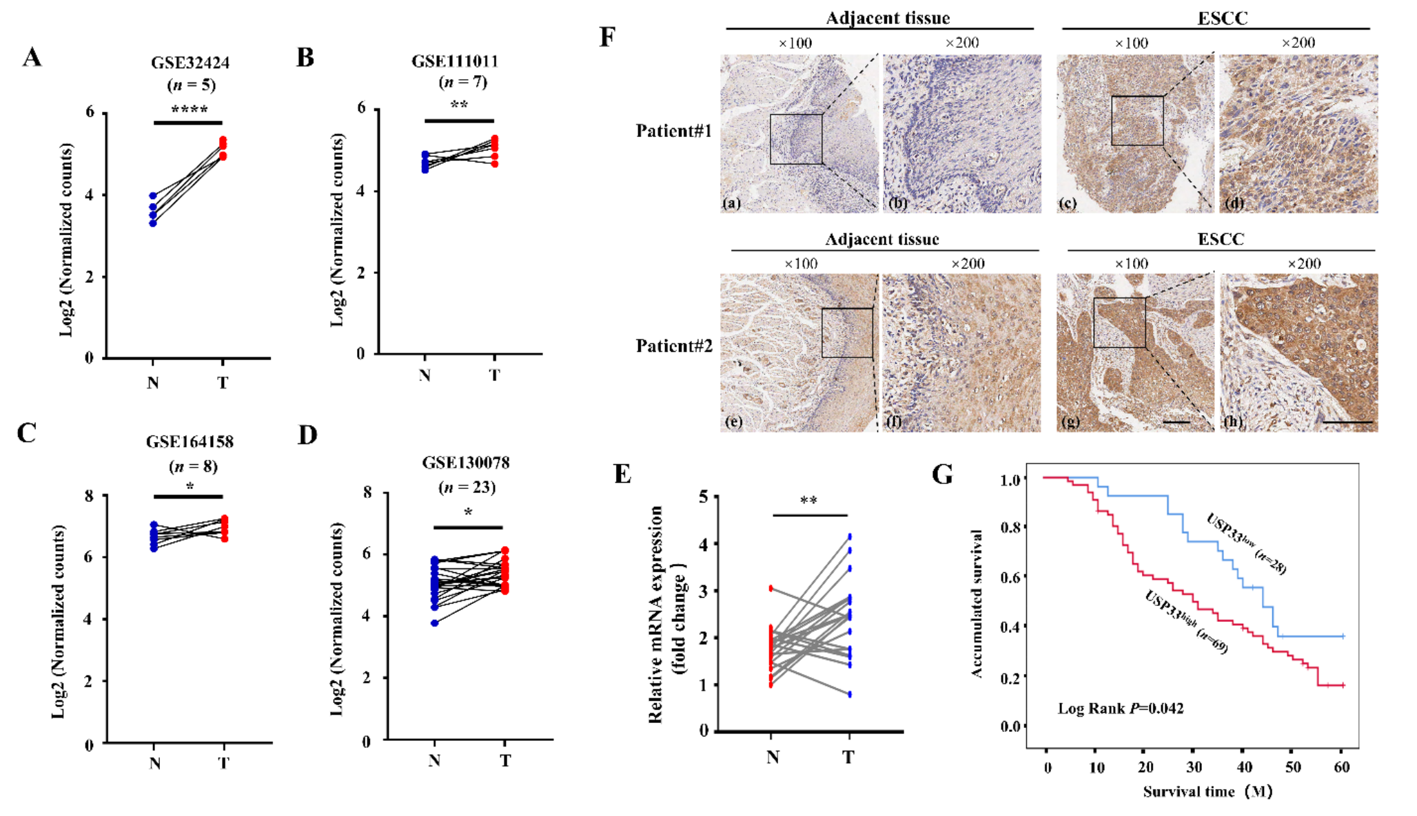 USP33 is an integrin α6 deubiquitinase and promotes esophageal squamous cell carcinoma cell migration and metastasis