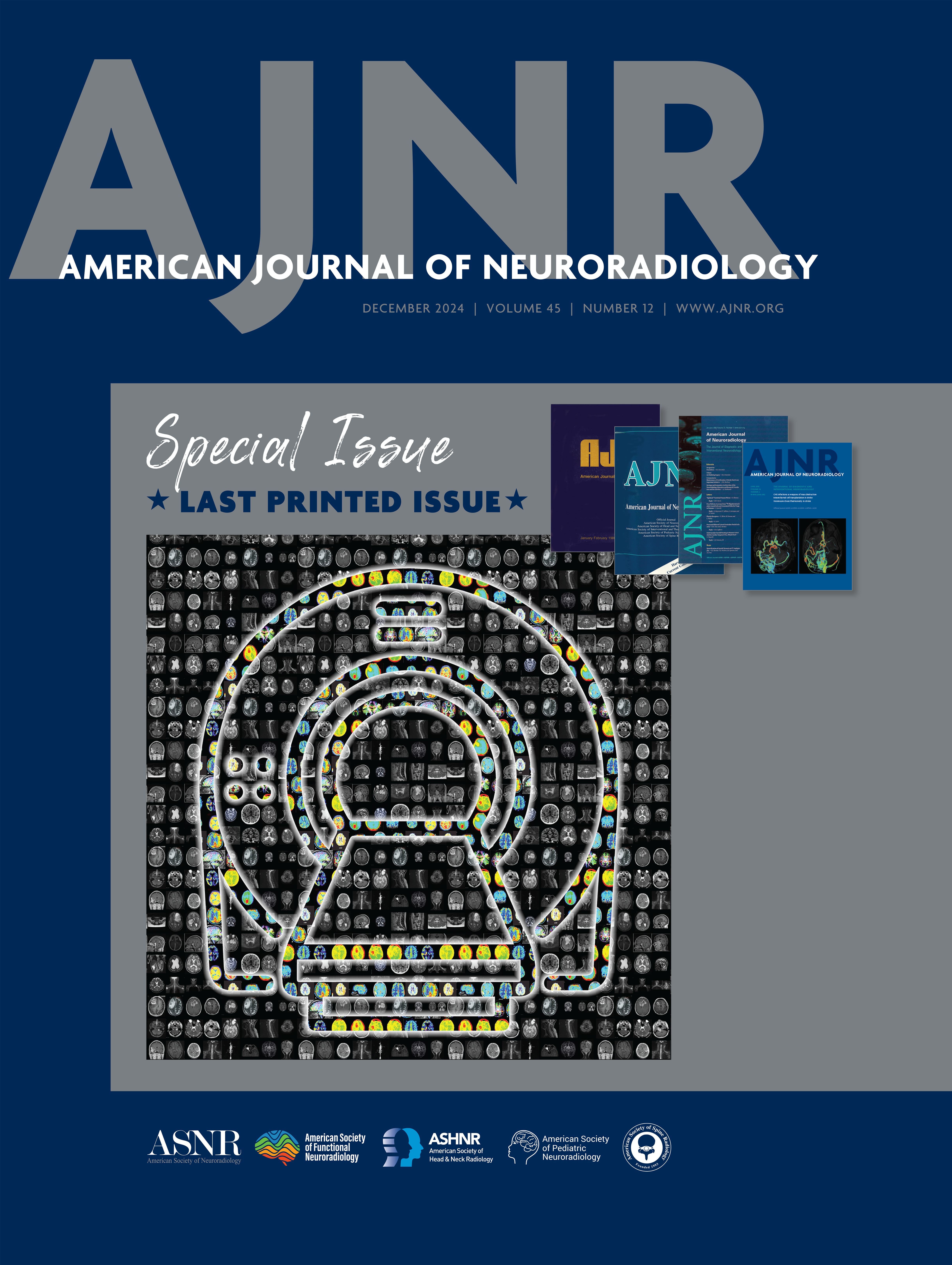 Autoimmune Encephalitis: Pathophysiology and Imaging Review of an Overlooked Diagnosis [CLINICAL PRACTICE]