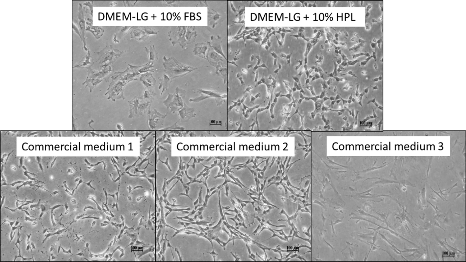 Comparing the growth kinetics and characteristics of Wharton’s jelly derived mesenchymal stem cells expanded using different culture mediums