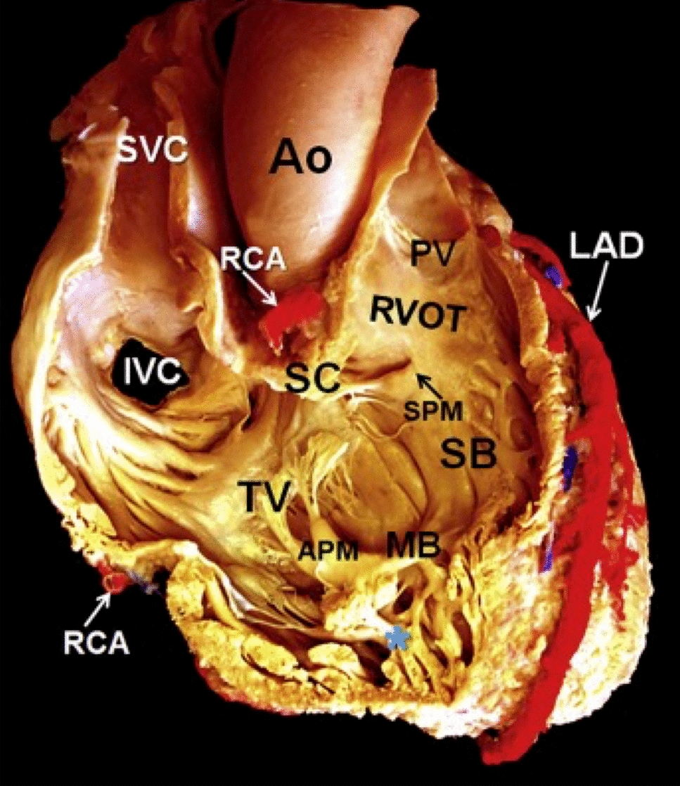 Right ventricular function in mitral stenosis: plays a fundamental role