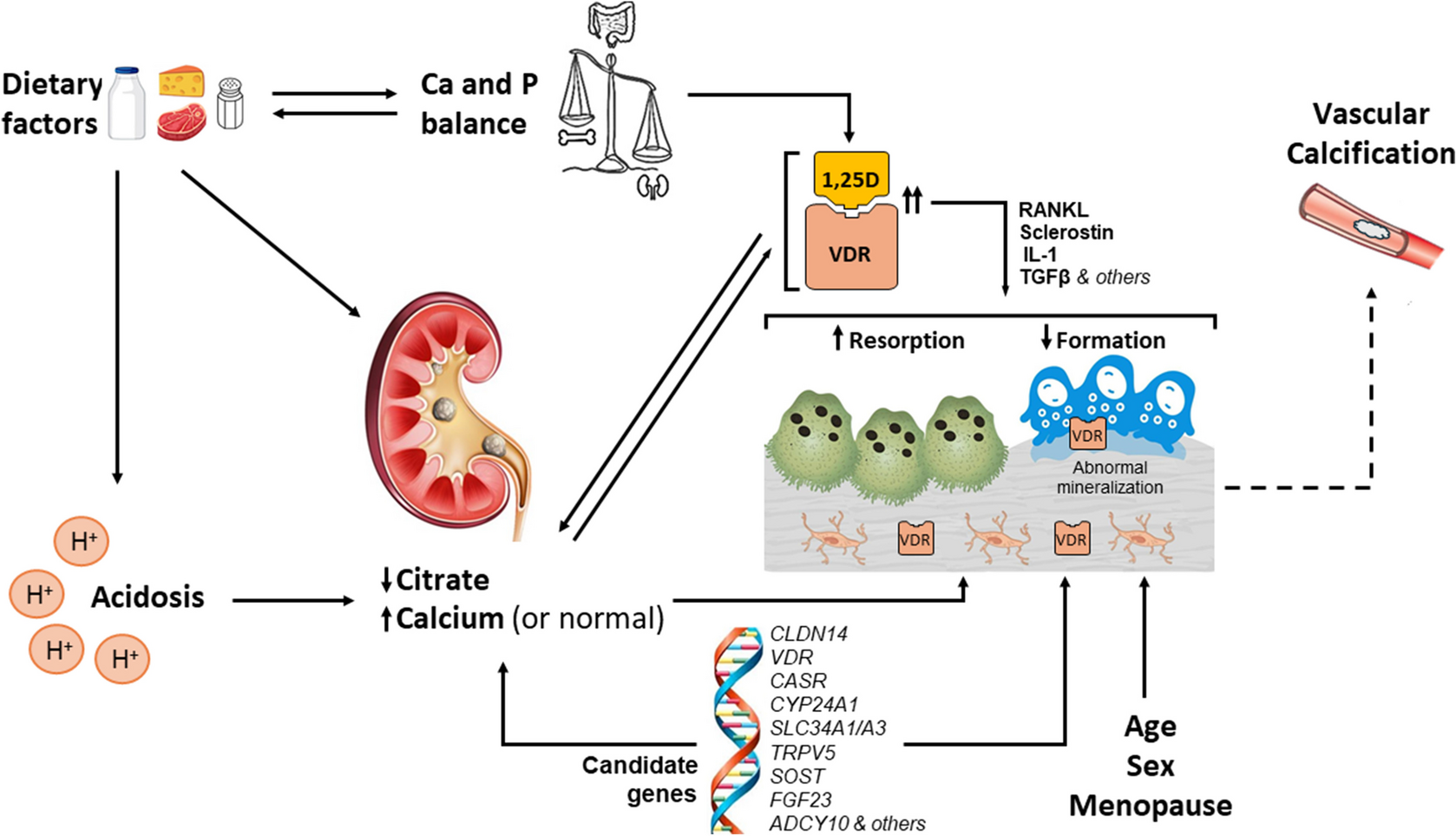 Between a Rock and a Short Place—The Impact of Nephrolithiasis on Skeletal Growth and Development Across the Lifespan