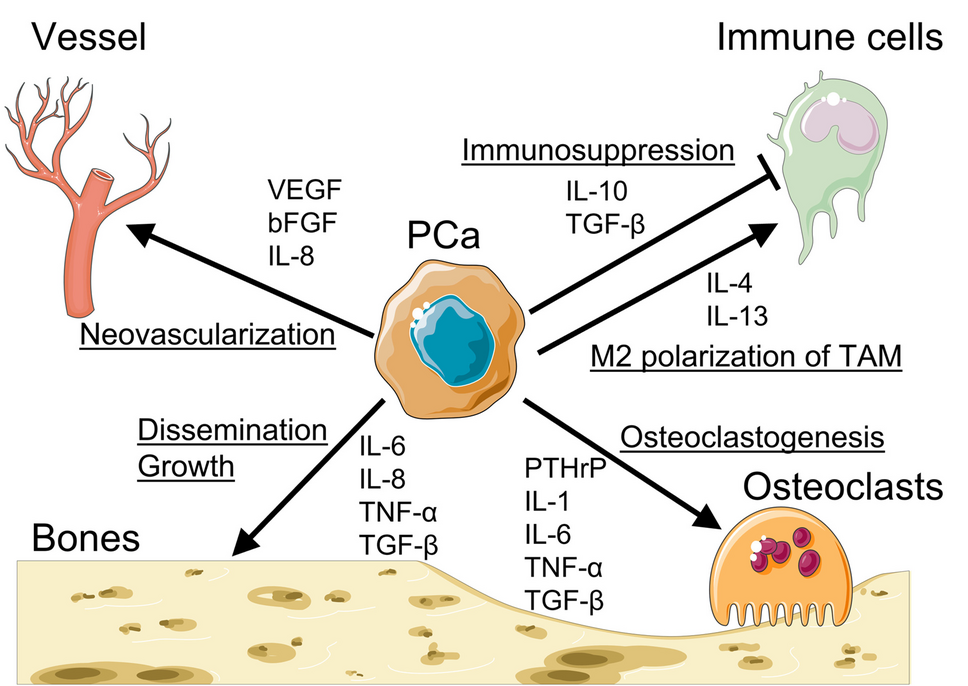 Role of Chemokines and Cytokines in Prostate Cancer Skeletal Metastasis