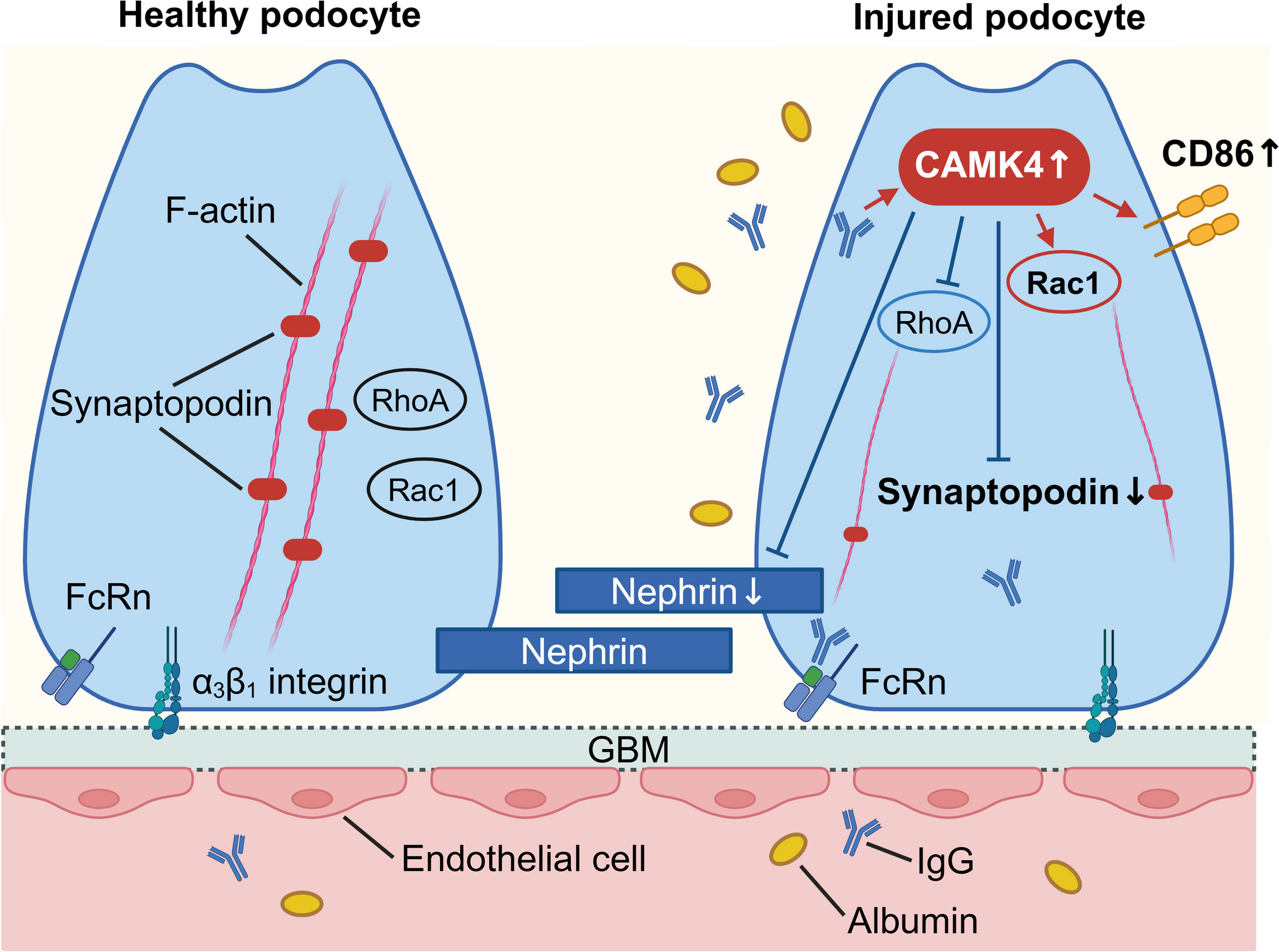 The Role of Podocytes in Lupus Pathology