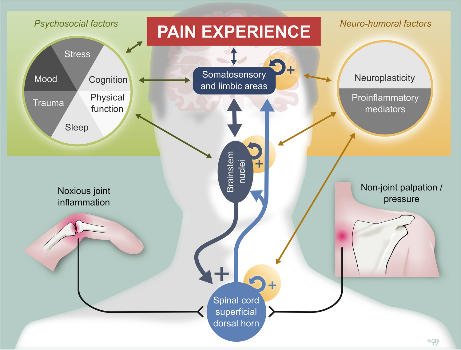 How to Distinguish Non-Inflammatory from Inflammatory Pain in RA?