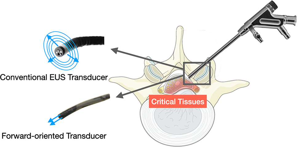 Spinal tissue identification using a Forward-oriented endoscopic ultrasound technique