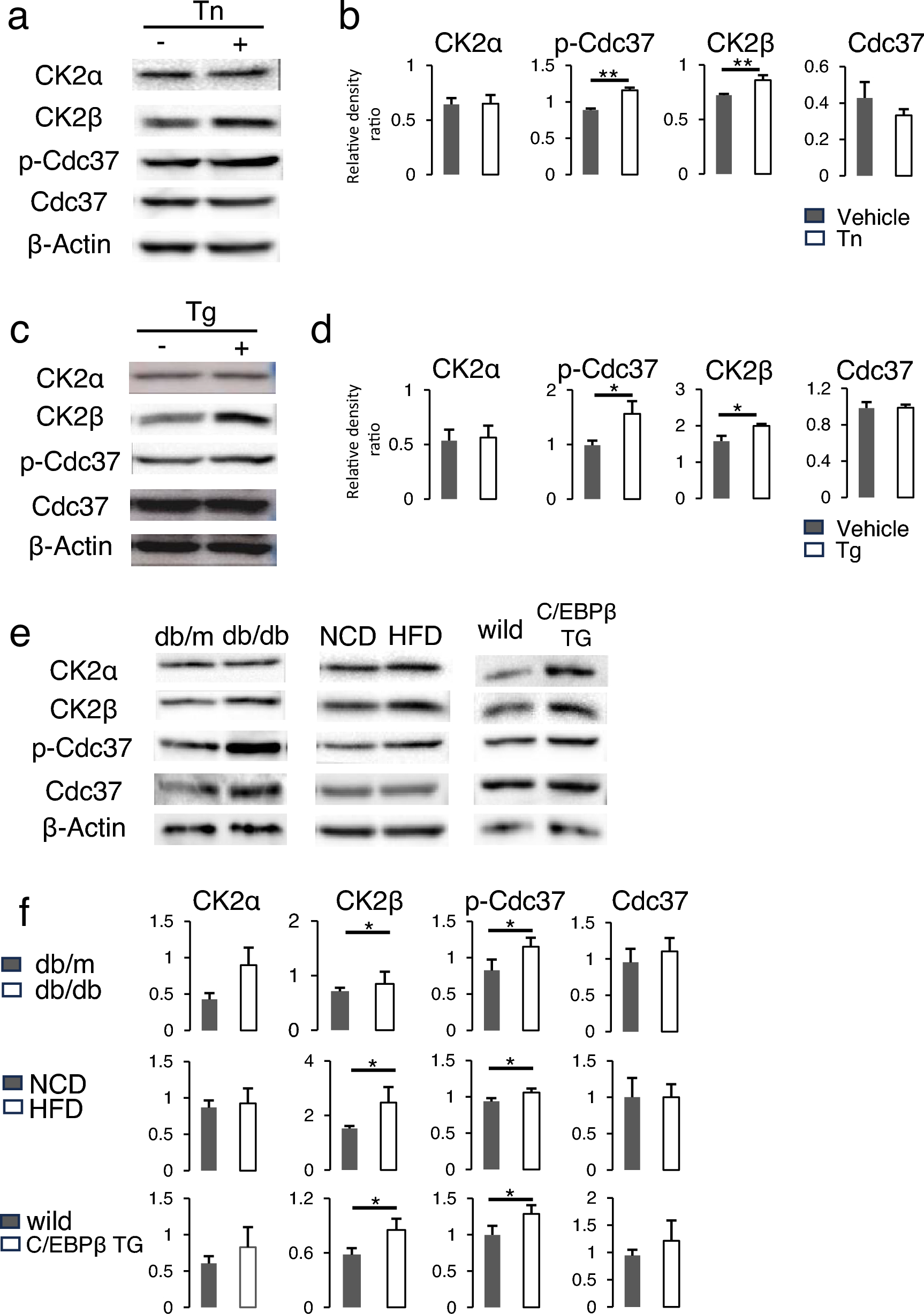 Protective effect of CK2 against endoplasmic reticulum stress in pancreatic β cells