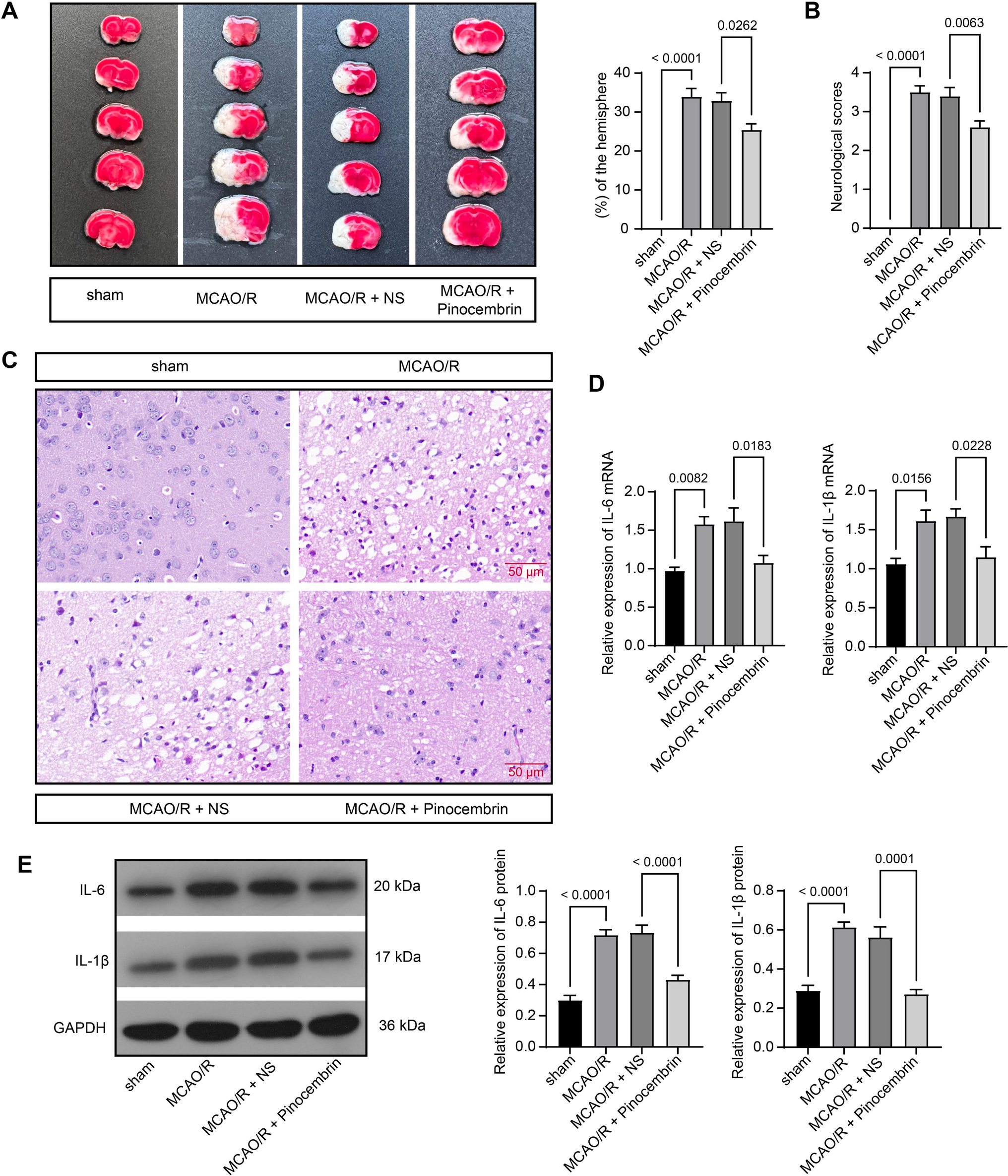 Pinocembrin activation of DPP9 inhibits NLRP1 inflammasome activation to alleviate cerebral ischemia/reperfusion-induced lung and intestinal injury