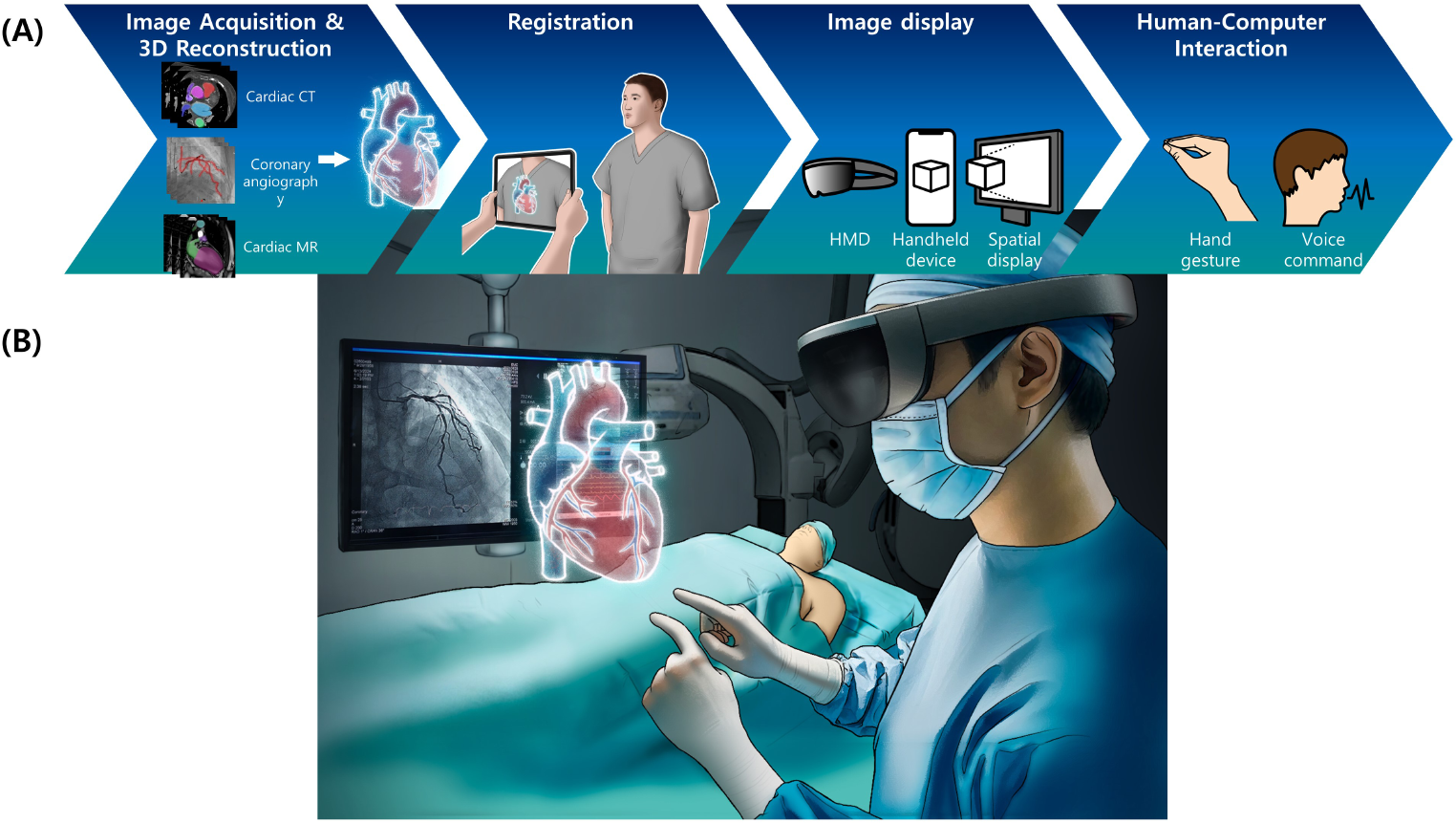 Augmented Reality in Cardiology: Enhancing Visualization and Precision