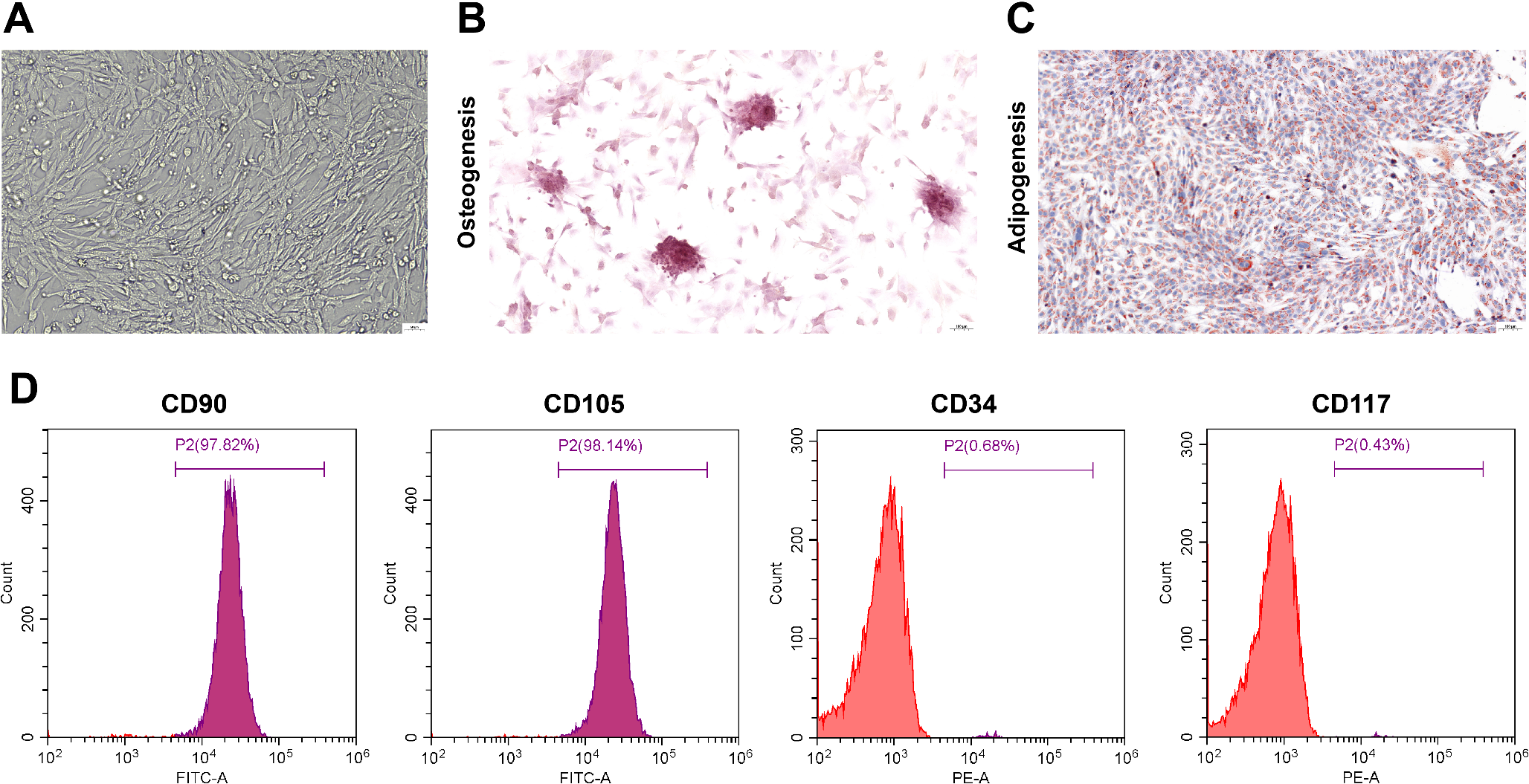 Epigenetic modification mediated by PHF20/METTL14/HOXA13 signaling axis modulates osteogenic differentiation of mesenchymal stem cells