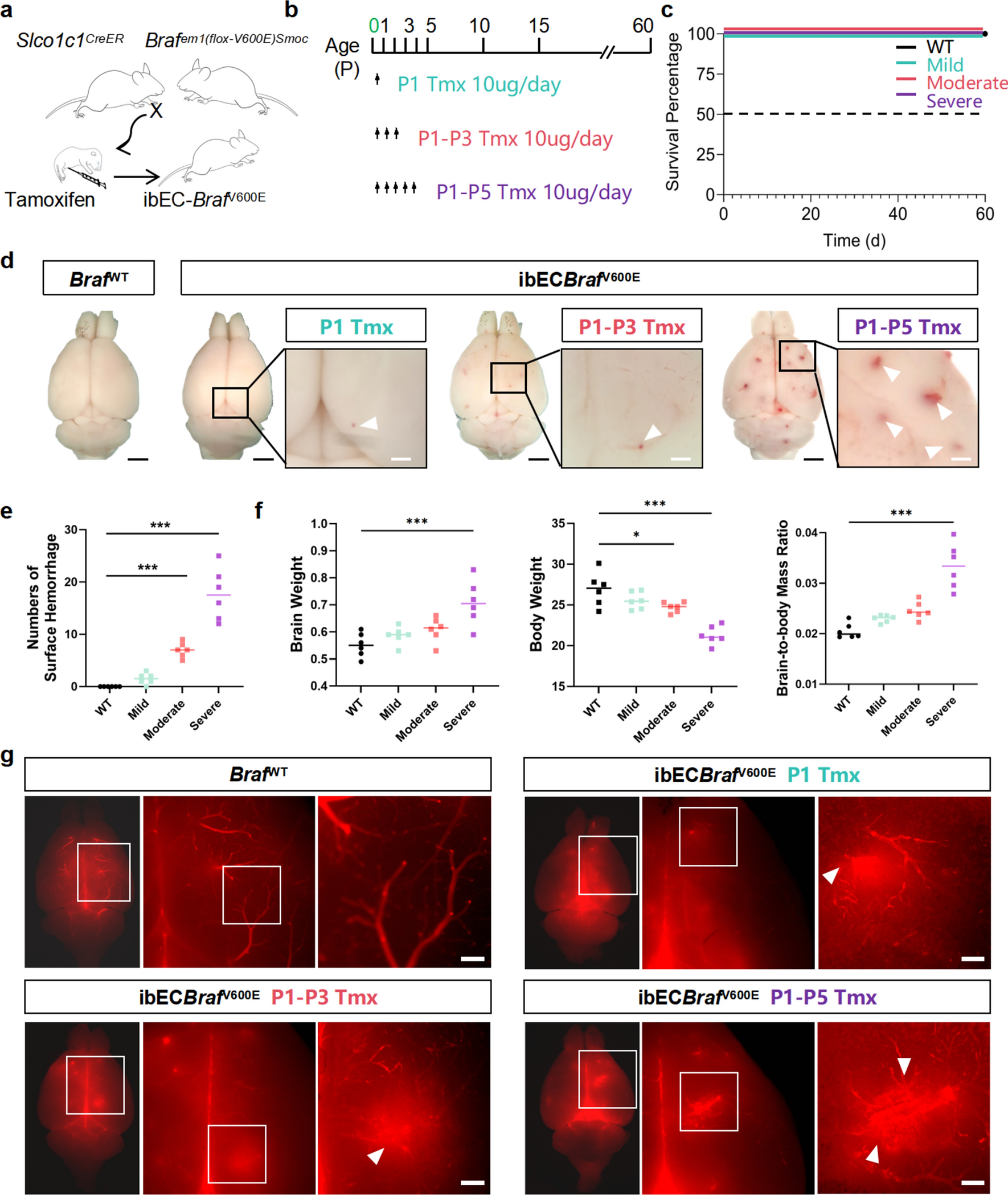 Inhibition of Angiopoietin-2 rescues sporadic brain arteriovenous malformations by reducing pericyte loss